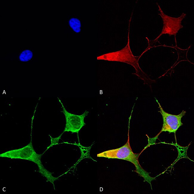 100UG ANKYRIN B ANTIBODY FITC 100 UG