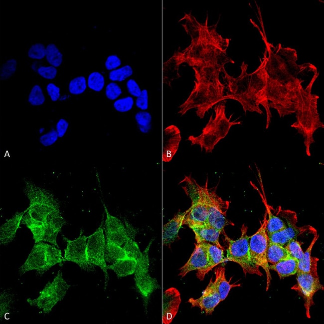 100UG ANKYRIN G ANTIBODY FITC 100 UG