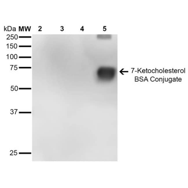 100UG 7-KETOCHOLESTEROL ANTIBODY APC 100