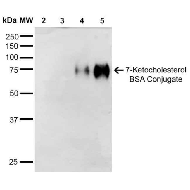 100UG 7-KETOCHOLESTEROL ANTIBODY FIT 100