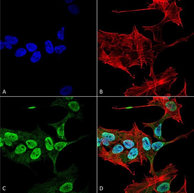 100UG ALPHA SYNUCLEIN ANTIBODY FITC 100