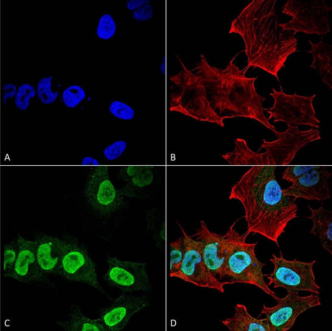 100UG ALPHA SYNUCLEIN ANTIBODY APC 100 U