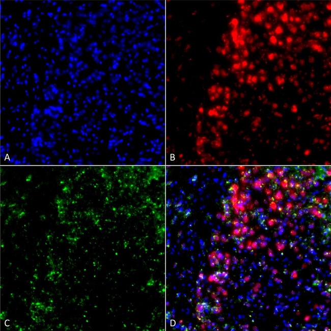 100UG ALPHA SYNUCLEIN ANTIBODY PERCP 100