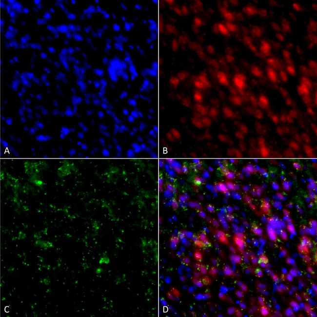 100UG ALPHA SYNUCLEIN ANTIBODY PERCP 100