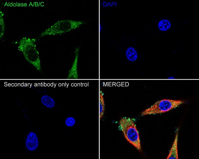 100UL ALDOLASE A/B/C RMAB 100 UL