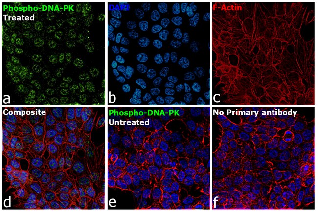 100UL PHOSPHO-DNA-PK (SER2056) RMAB 100