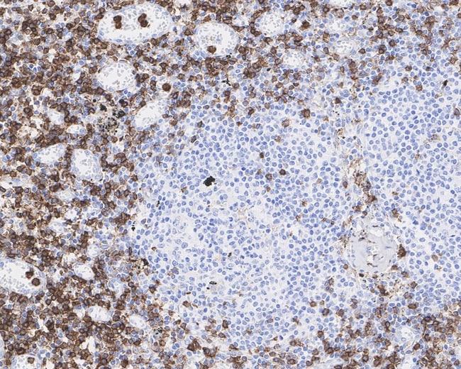 100UL ANNEXIN A1 100 UL