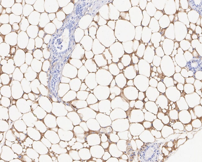 100UL ADIPONECTIN 100 UL
