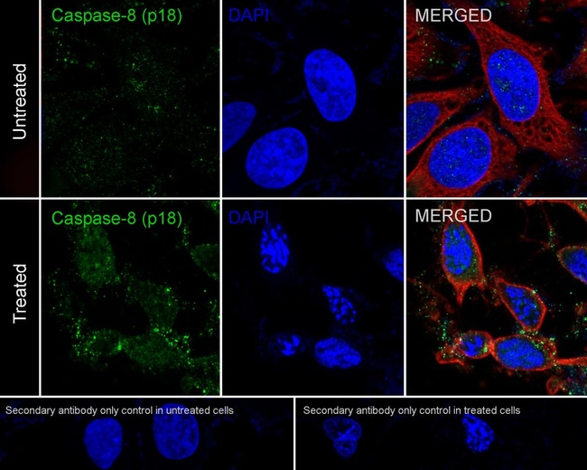 100UL CASPASE 8 100 UL