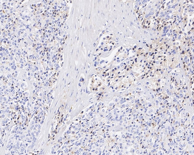 100UL APOLIPOPROTEIN J 100 UL