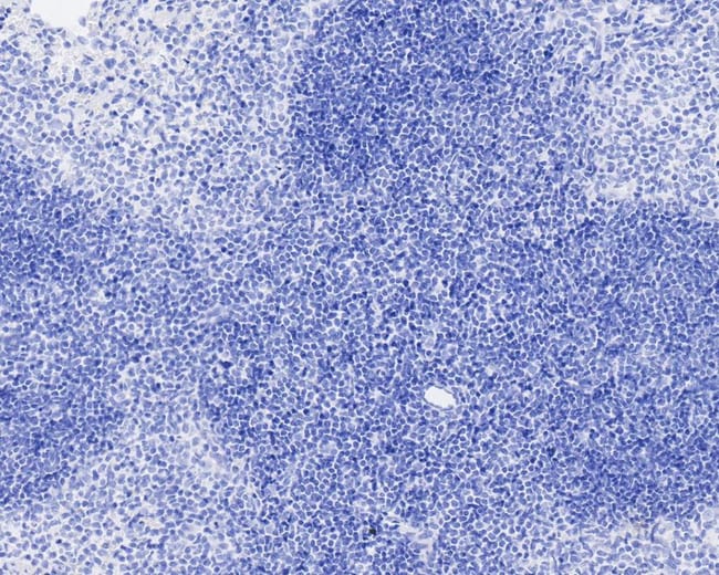 100UL DIGOXIGENIN 100 UL