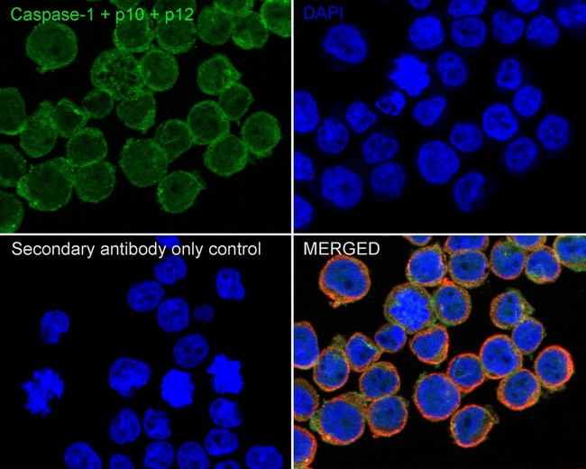 100UL CASPASE 1 P10/P12 100 UL