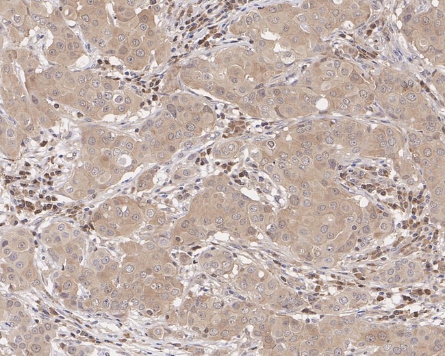100UL CASPASE 3 P12 100 UL