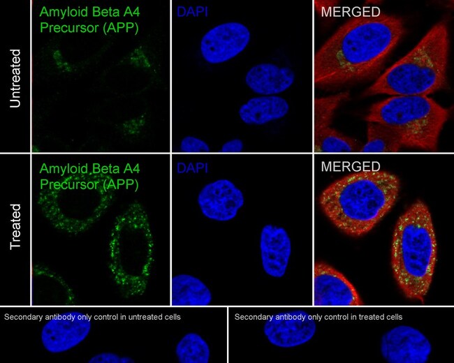 100UL AMYLOID PRECURSOR PROTEIN 100 UL
