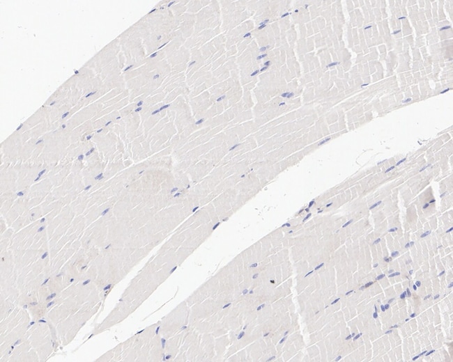 100UL AMYLOID PRECURSOR PROTEIN 100 UL