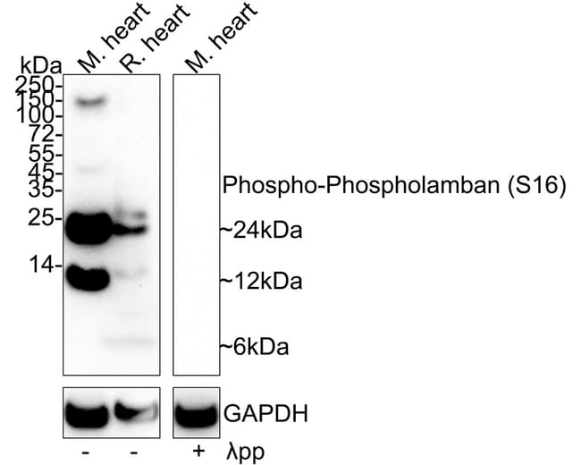 100UL PHOSPHO-PHOSPHOLAMBAN (SER16) 100