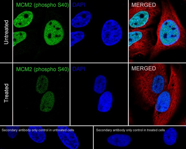 100UL PHOSPHO-MCM2 (SER40) 100 UL