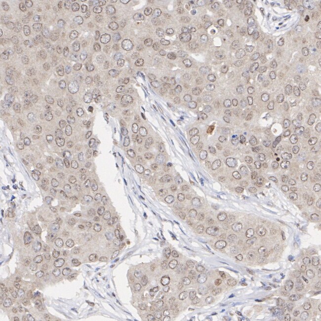 100UL PHOSPHO-AKT1/AKT2/AKT3 (SER473 100