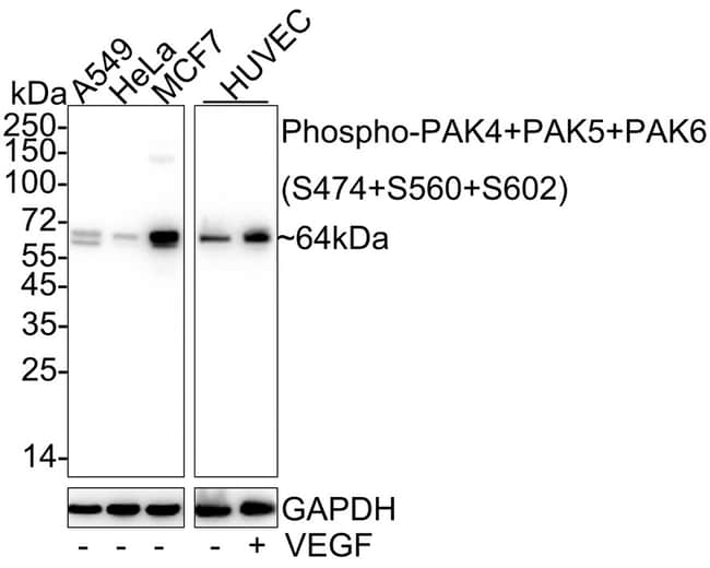 100UL PHOSPHO-PAK4/6/7 (SER474, SER 100