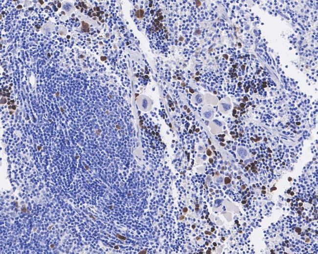 100UL PHOSPHO-CDK1/CDK2/CDK3 (THR14) 100