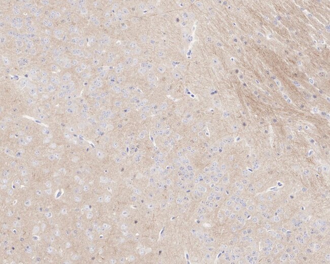 100UL PHOSPHO-TAU (THR181) 100 UL