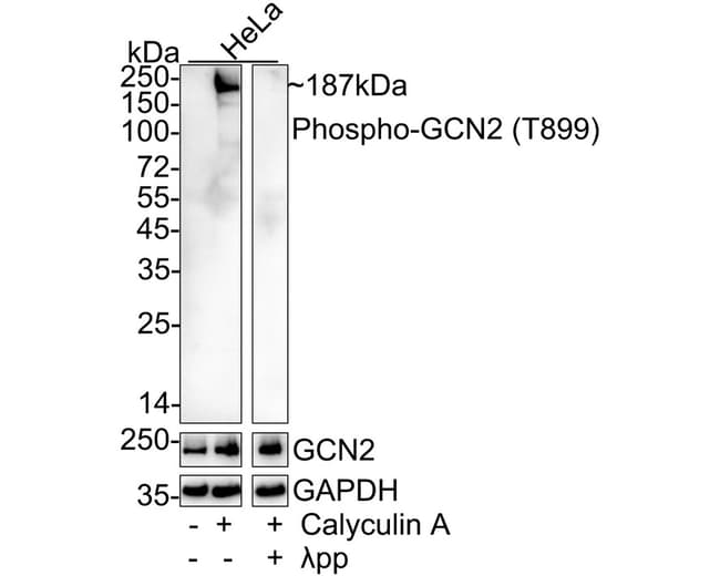 100UL PHOSPHO-GCN2 (THR899) 100 UL
