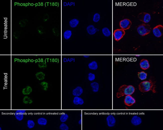 100UL PHOSPHO-P38 MAPK (THR180) 100 UL