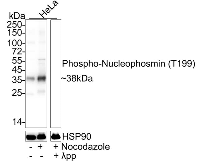 100UL PHOSPHO-NPM1 (THR199) 100 UL