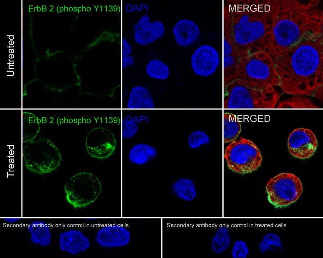 100UL PHOSPHO-ERBB2 (HER-2) (TYR1139 100