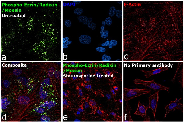 100UL PHOSPHO-EZRIN/RADIXIN/MOE RMAB 100
