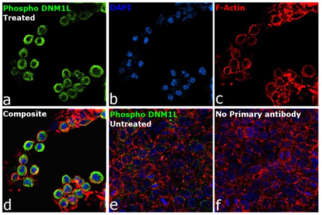 100UL PHOSPHO-DNM1L (SER616) RE RMAB 100