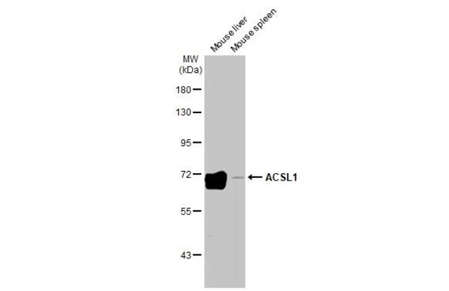 100UL ACSL1 RMAB 100 UL