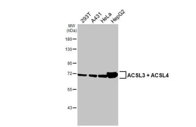 100UL ACSL3/ACSL4 RMAB 100 UL
