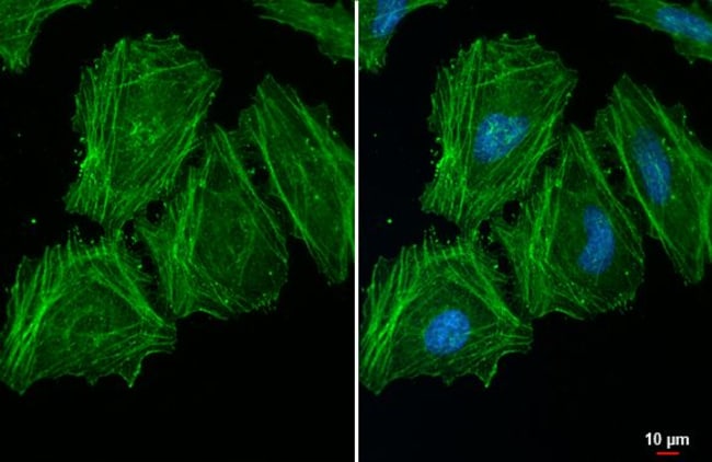 100UL ACTIN RMAB 100 UL