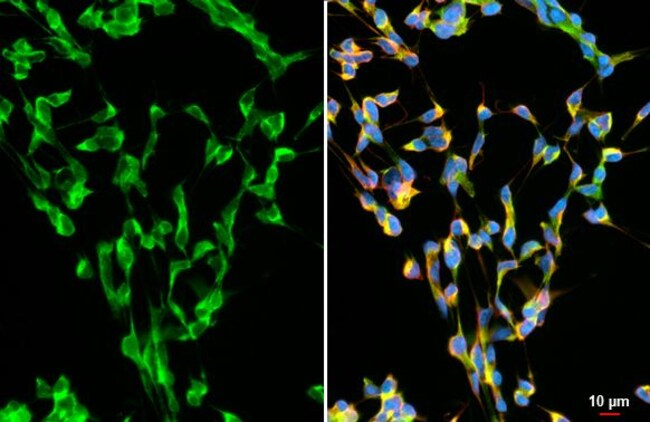 100UL ALPHA SYNUCLEIN RMAB 100 UL