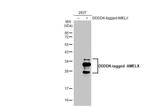 100UL AMELX RMAB 100 UL