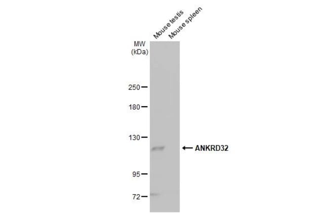 100UL ANKRD32 RMAB 100 UL