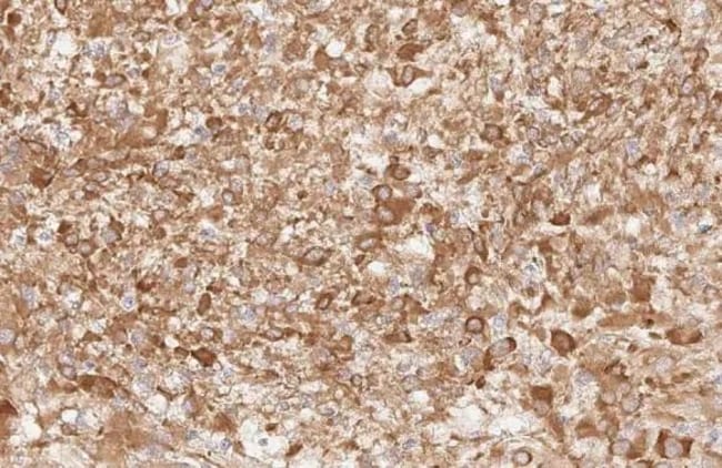 100UL APELIN RECEPTOR RMAB 100 UL
