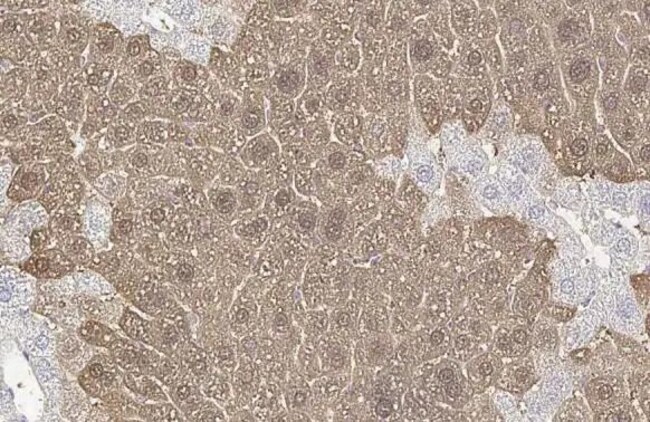 100UL ARGINASE 1 RMAB 100 UL