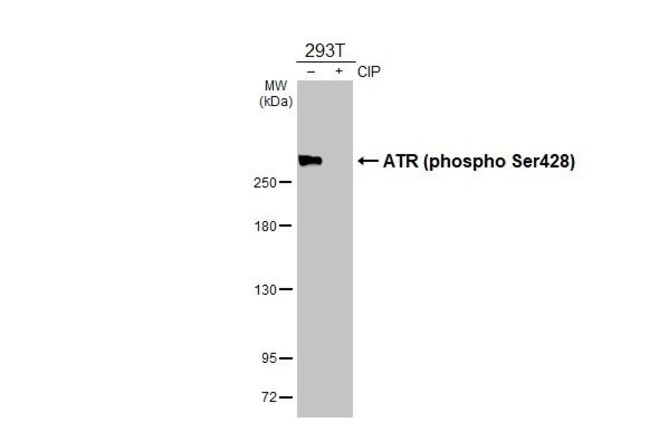 100UL PHOSPHO-ATR (SER428) RMAB 100 UL