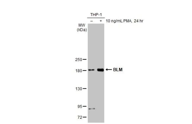 100UL BLOOMS SYNDROME RMAB 100 UL