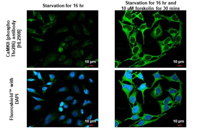 100UL PHOSPHO-CAMKII ALPHA (THR RMAB 100