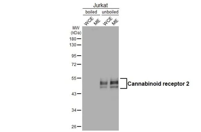 100UL CNR2 RMAB 100 UL