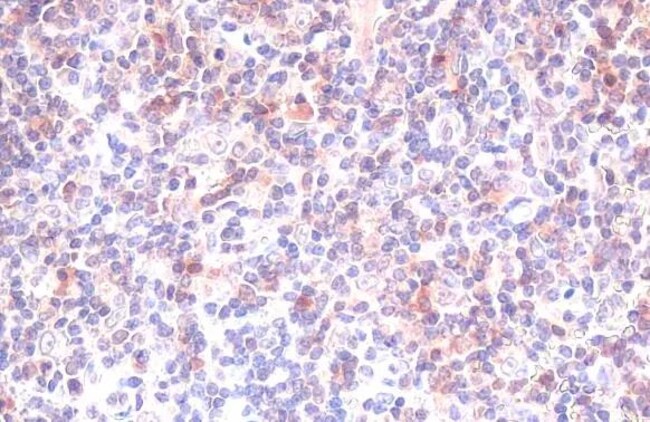 100UL CASPASE 3 RMAB 100 UL