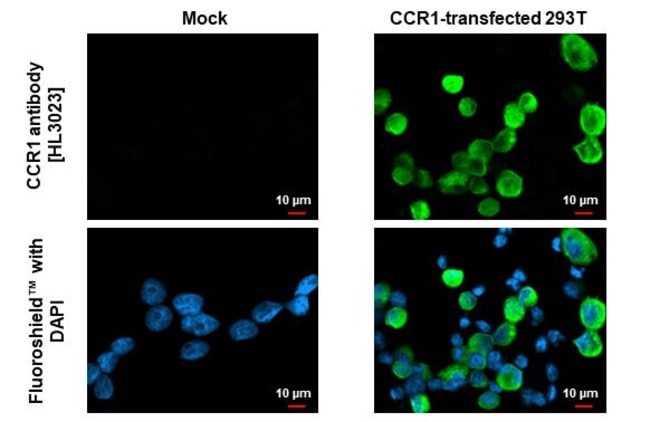100UL CCR1 RMAB 100 UL