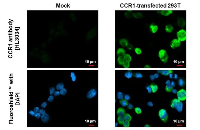 100UL CCR1 RMAB 100 UL