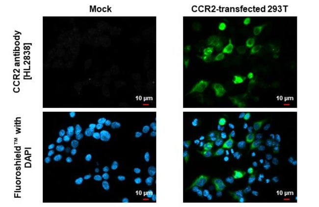 100UL CCR2 RMAB 100 UL