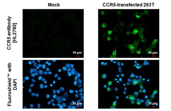 100UL CCR5 RMAB 100 UL