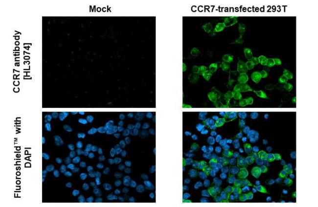 100UL CCR7 RMAB 100 UL