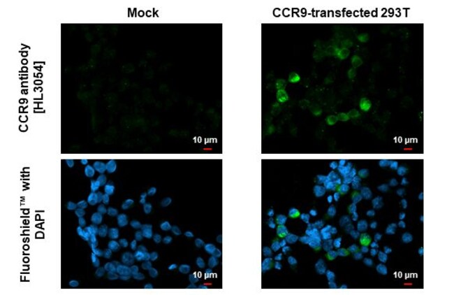 100UL CCR9 RMAB 100 UL